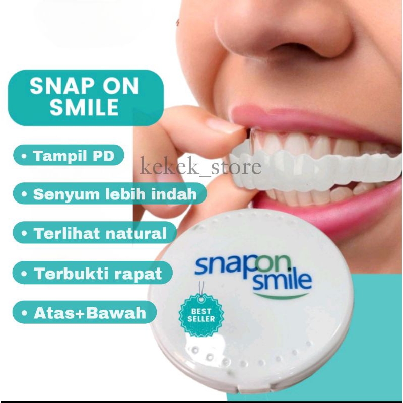 Snap On Smile Veneer Gigi Palsu Instan Original Solusi Ompong Kuning Rusak  Perapi ( Satu Set )