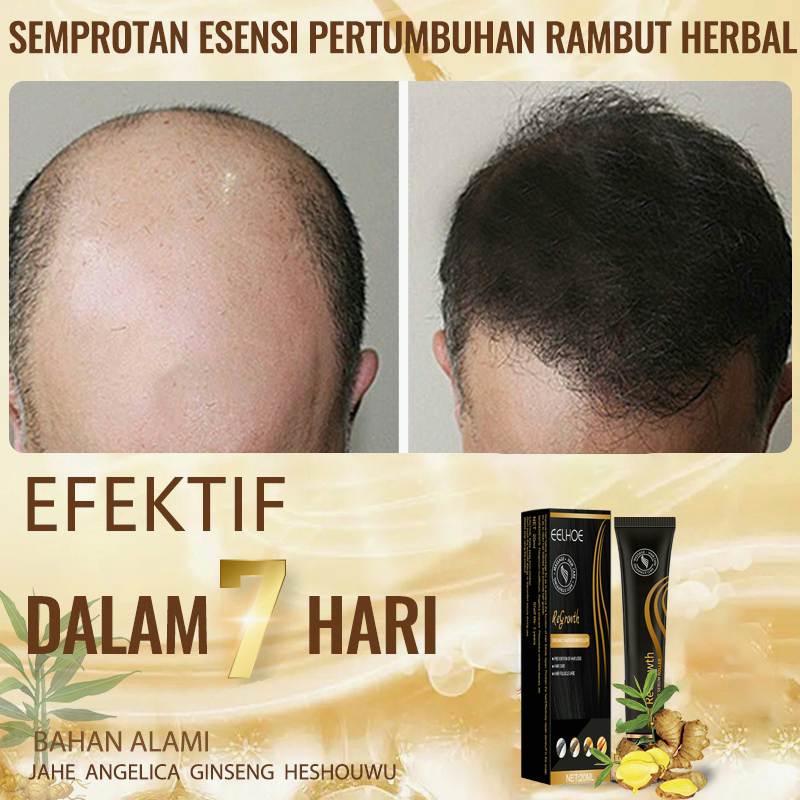 【ORIGINAL】penumbuh rambut Hair growth serum penumbuh rambut botak serum penumbuh rambut 20ml serum rambut rontok Penumbuh Rambut Cepat Anti Rontok Mengatasi Botak