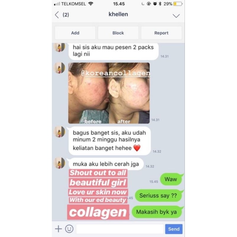 ED LAB COLLAGEN Minuman Pemutih Tubuh &amp; Badan Terdaftar BPOM