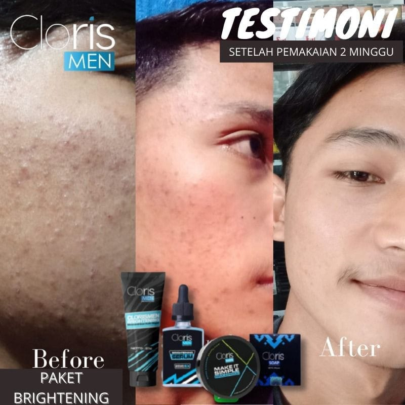 Clorismen Skincare Paket Lengkap Brightening Acne Perawatan Wajah Pria Berjerawat Pembersih Wajah Berminyak Pemutih Wajah Kusam Pelembab Muka Cowok