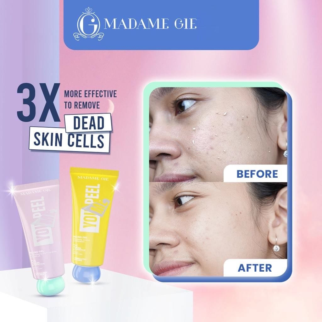 `ღ´ PHINKL `ღ´Madame Gie Peeling gel eksfoliasi kulit wajah leher badan peel off