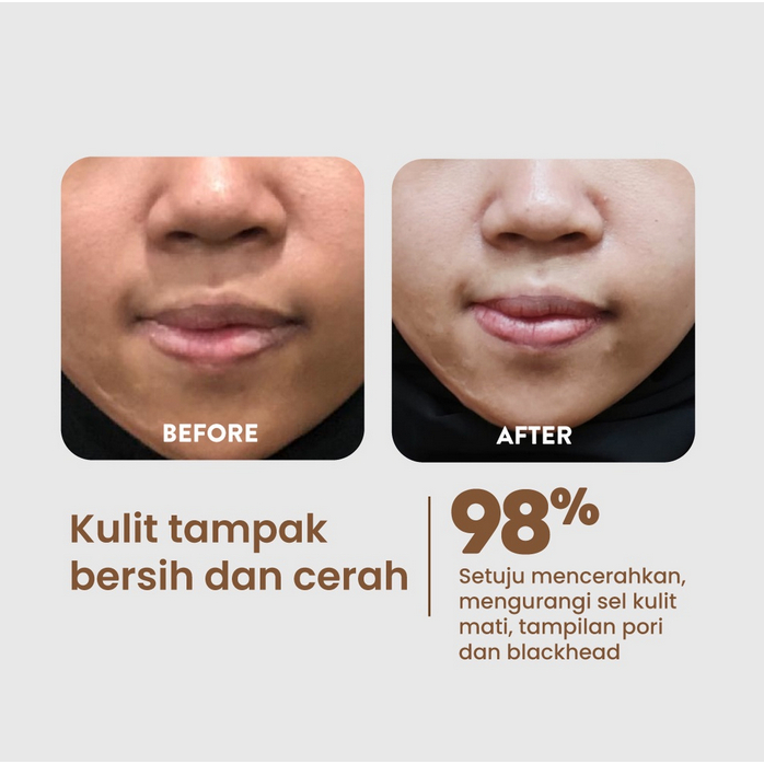 NPURE Licorice Milky Spotlight Toner wajah perawatan kecantikan cewe cowo cewek cowok perempuan anti aging kerutan garis halus mencerahkan jerawat acne prone pori pori blackhead