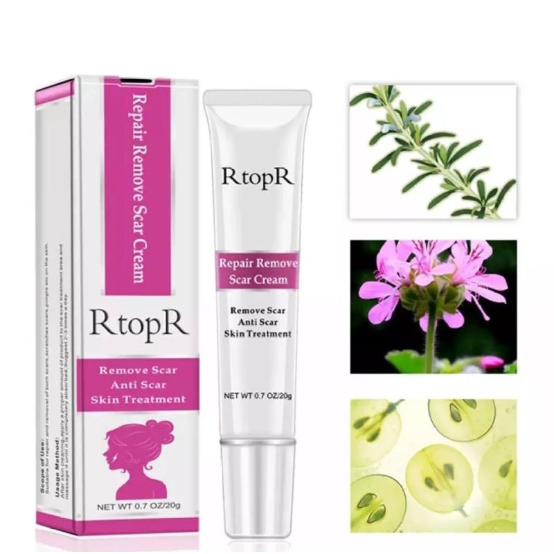 RTOPR MANGO REMOVE PREGNANCY SCARS ACNE CREAM STERCTH MARKS TREATMENT MATERNITY REPAIR ANTI AGING-40ml