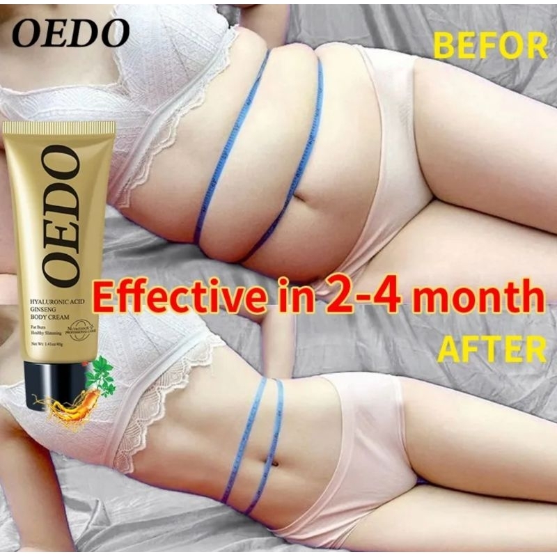 OEDO HYALURONIC ACID GINGSENG SLIMMING CREAM REDUCE CELLULITE LOSE WEIGHT BURNING FAT SLIMMING CARE HEALTH CARE