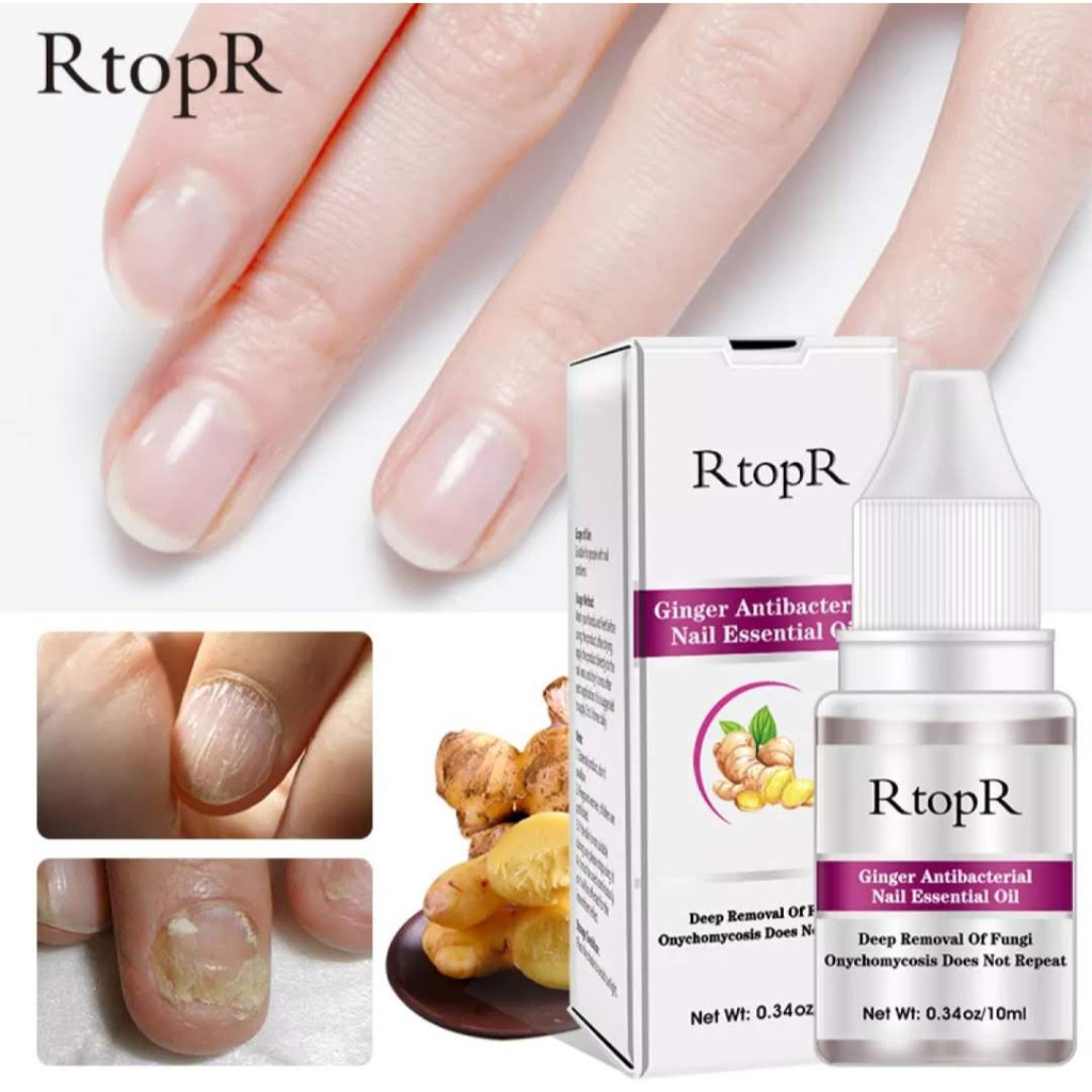 RtopR Ginger Antibacterial Nail Essential Oil Minyak Esensial Perawatan Kuku Jahe, Anti Jamur Infeksi Kuku Jari Kaki 10Ml