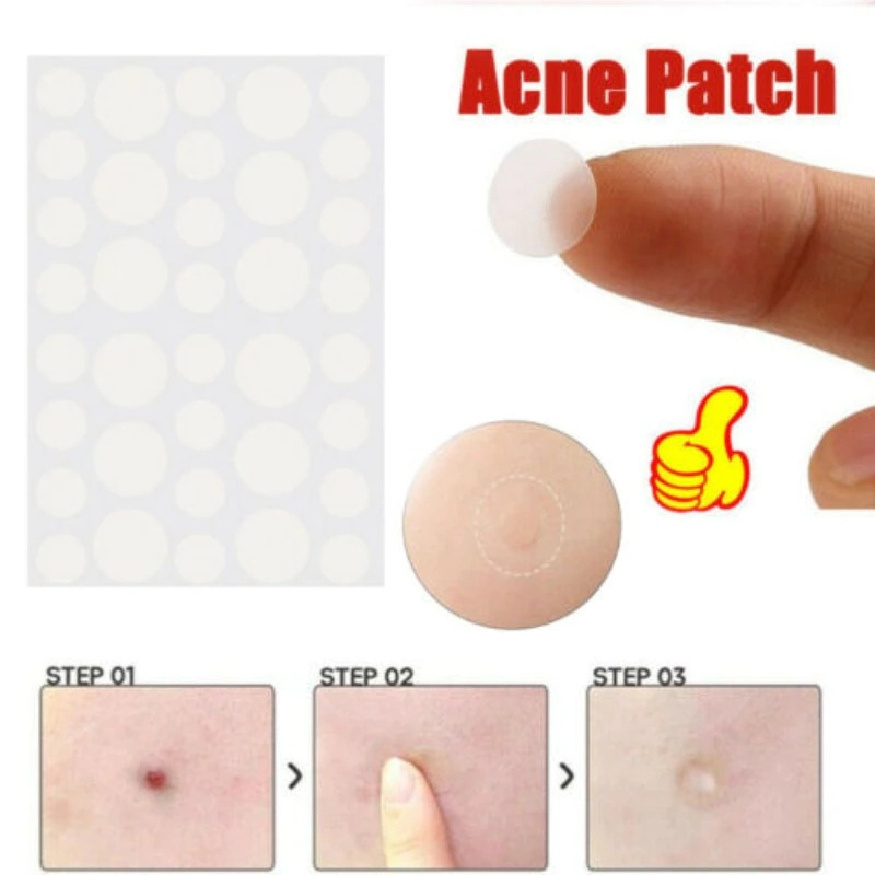 Tag Jerawat Invisible Acne Pimple Skin Patch 36 PCS - PT5 - Transparent