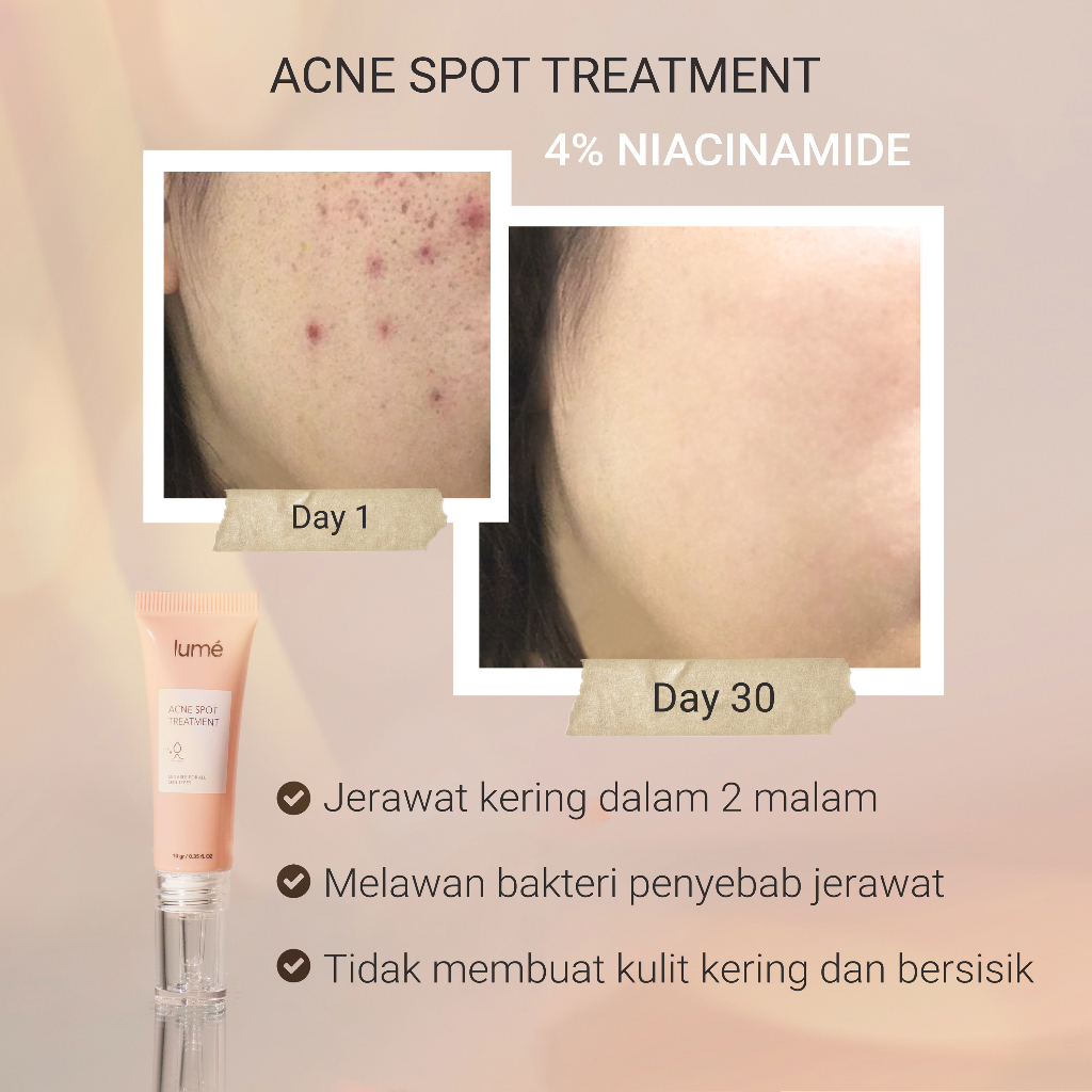 (Free Emas 24K) LUME Acne Spot Treatment 10gr Skincare Gel Anti Jerawat