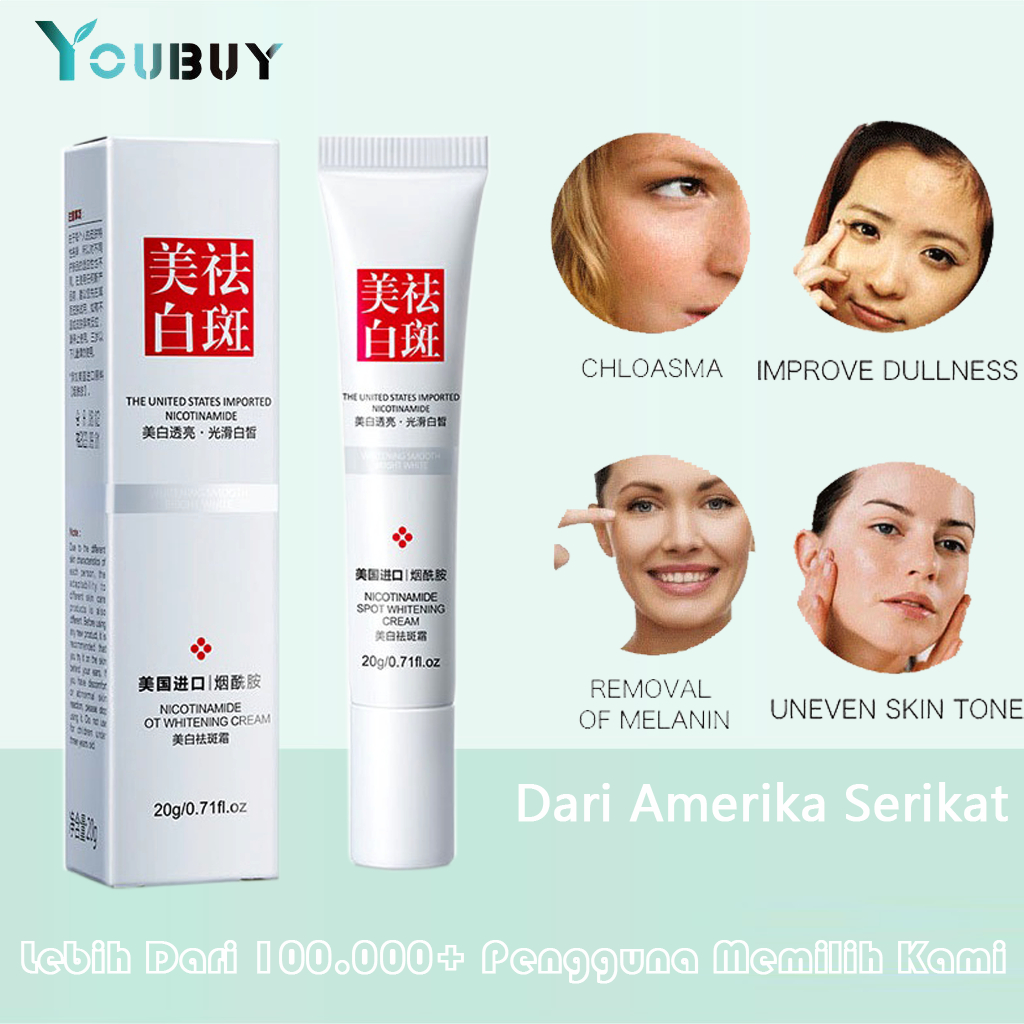 Youbuy Whitening Freckle Cream Remove Dark Spots Anti Freckle Cream Niacinamide Fade Pigmentation Me