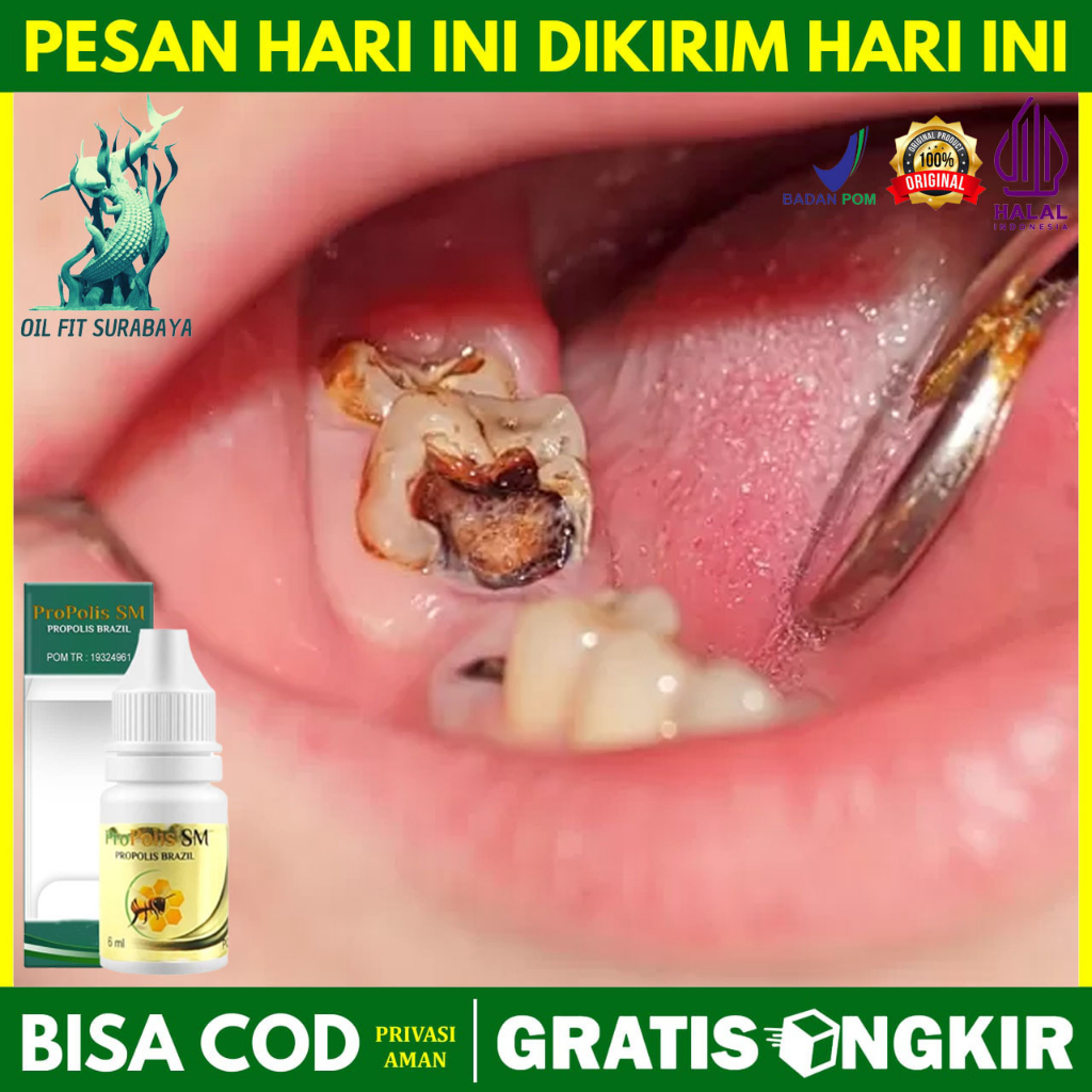 Obat Herbal Untuk Mengeluarkan Ulat Gigi - Cara Keluarkan Ulat Gigi Alami - Cara Hilangkan Ulat Gigi