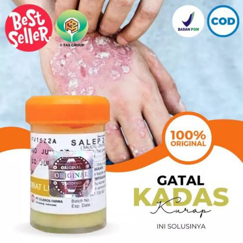 Salep 24 Zwafel Original Obat Kulit Gatal Selangkangan Panu Jerawat Eksim