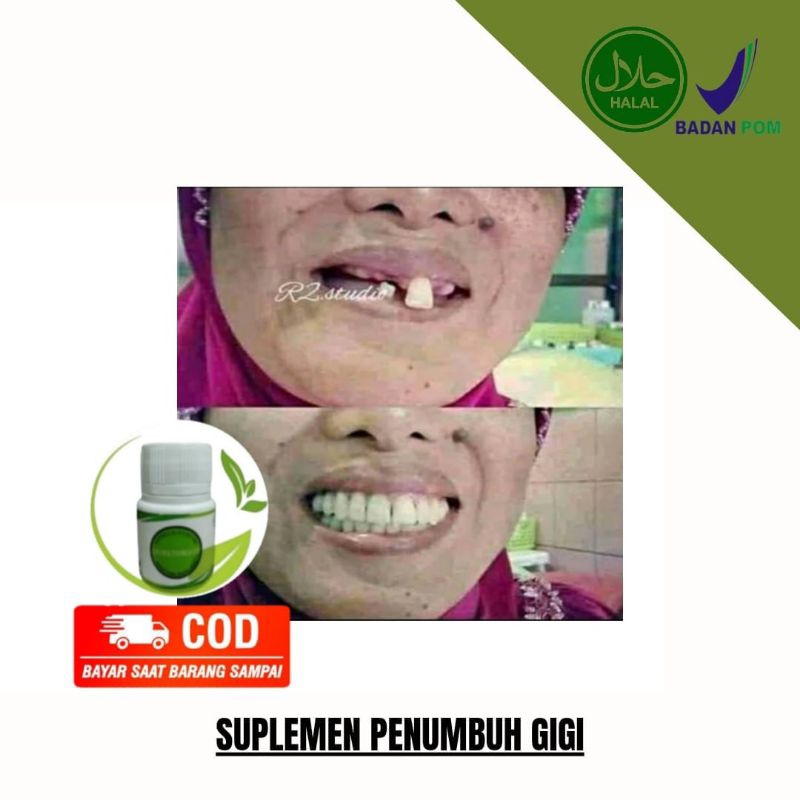 SUPLEMEN PENUMBUH GIGI BOLONG,PATAH,BERLUBANGAMPUH ORIGINAL 100%