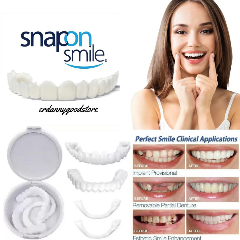 ✅[ TERLARIS ] Snap On Smile ORI Authentic | Snap 'n Smile Gigi Palsu | Veneer Instan Gigi Palsu 1 Set Sepasang Gigi Atas Dan Bawah