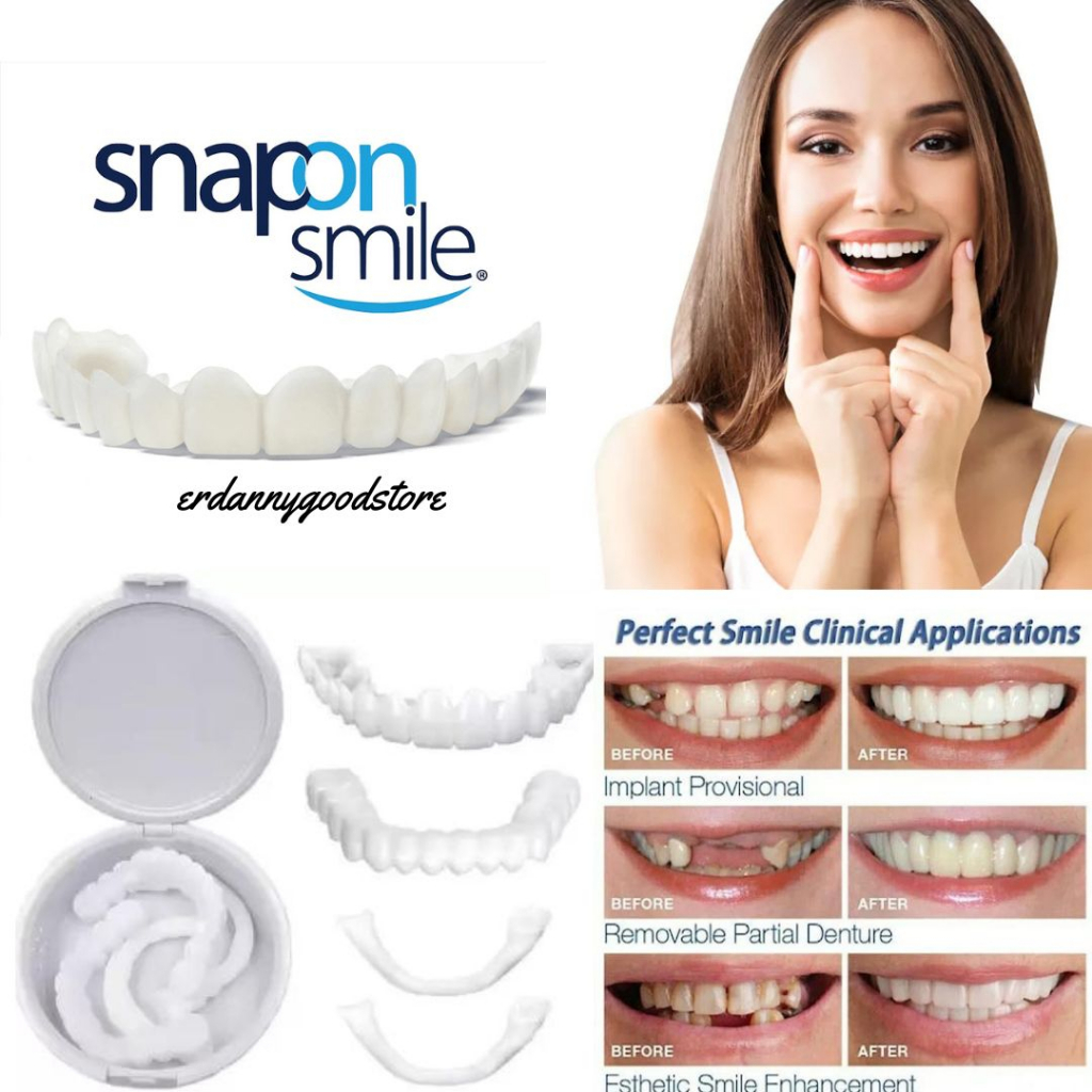 ✅[ TERLARIS ] Snap On Smile ORI Authentic | Snap 'n Smile Gigi Palsu | Veneer Instan Gigi Palsu 1 Se