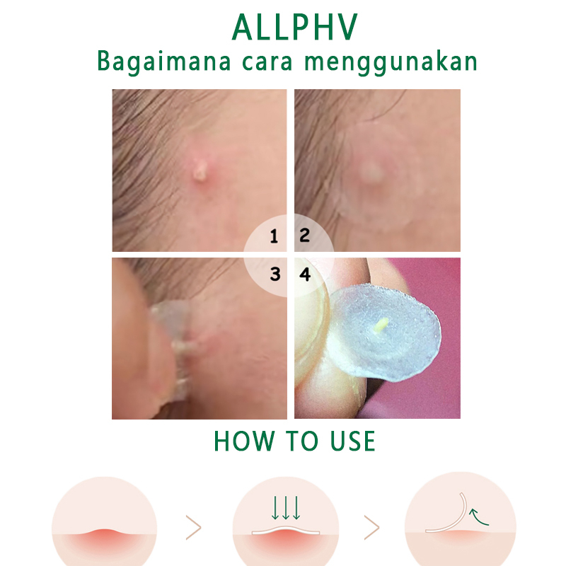 ALLPHV Acne Pimple Patch Removal Penghilang Jerawat Skincare Kit Menghilangkan jerawat Facial Cleanser Jerawat Pemulihan