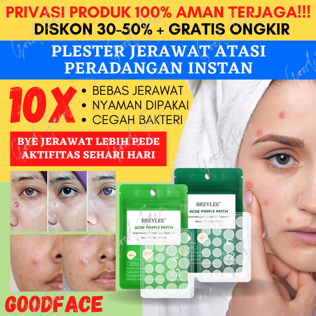 Penghilang Jerawat BREYLEE Acne Pimple Patch Day|Night - Penghilang &amp; Stiker Jerawat 0.1mm|0.3 mm