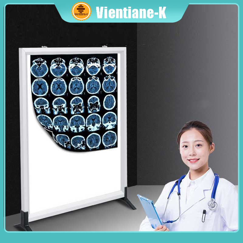 Lampu Baca Rontgen Film Viewer Xray X Ray Viewer  Viewer Lampu Xray Rontgen Gigi