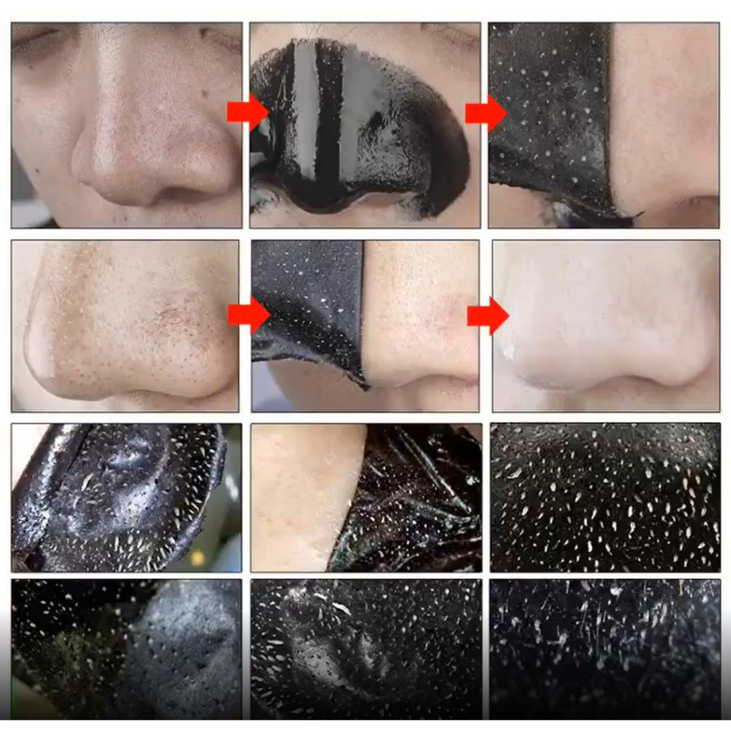 [Barang Spot] Masker Komedo Masker Komedo Kuat masker Masker penghilang komedo 120g Untuk pria wanita masker wajah penghilang komedo masker menghilangkan komedo bahan botani Ringan dan tidak menyebabkan iritasi