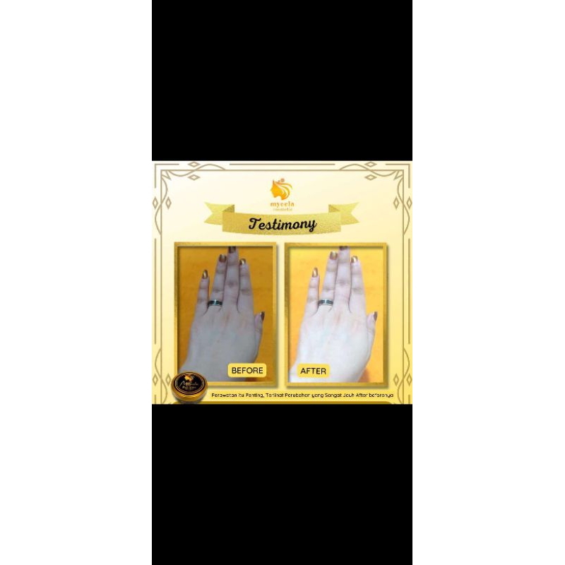 paket body lotion/Hb/handbody/body lotion/body care 𝐌𝐲cela dan sabun 3 pcs collagen mycela