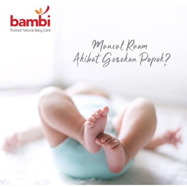 [BPOM] Bambi Baby Diaper Rash Cream 50ml / Krim Ruam Popok Pada Bayi Kulit Normal Sensitif / Krim Area Lipatan / Mencegah Iritasi Ringan / MY MOM