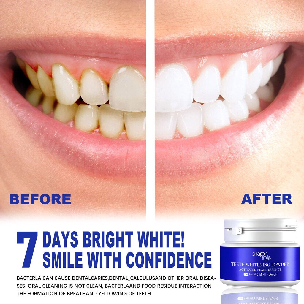 Snap On Smile Teeth Whitening Powder Pemutih Gigi Kuning Permanen Paling Ampuh