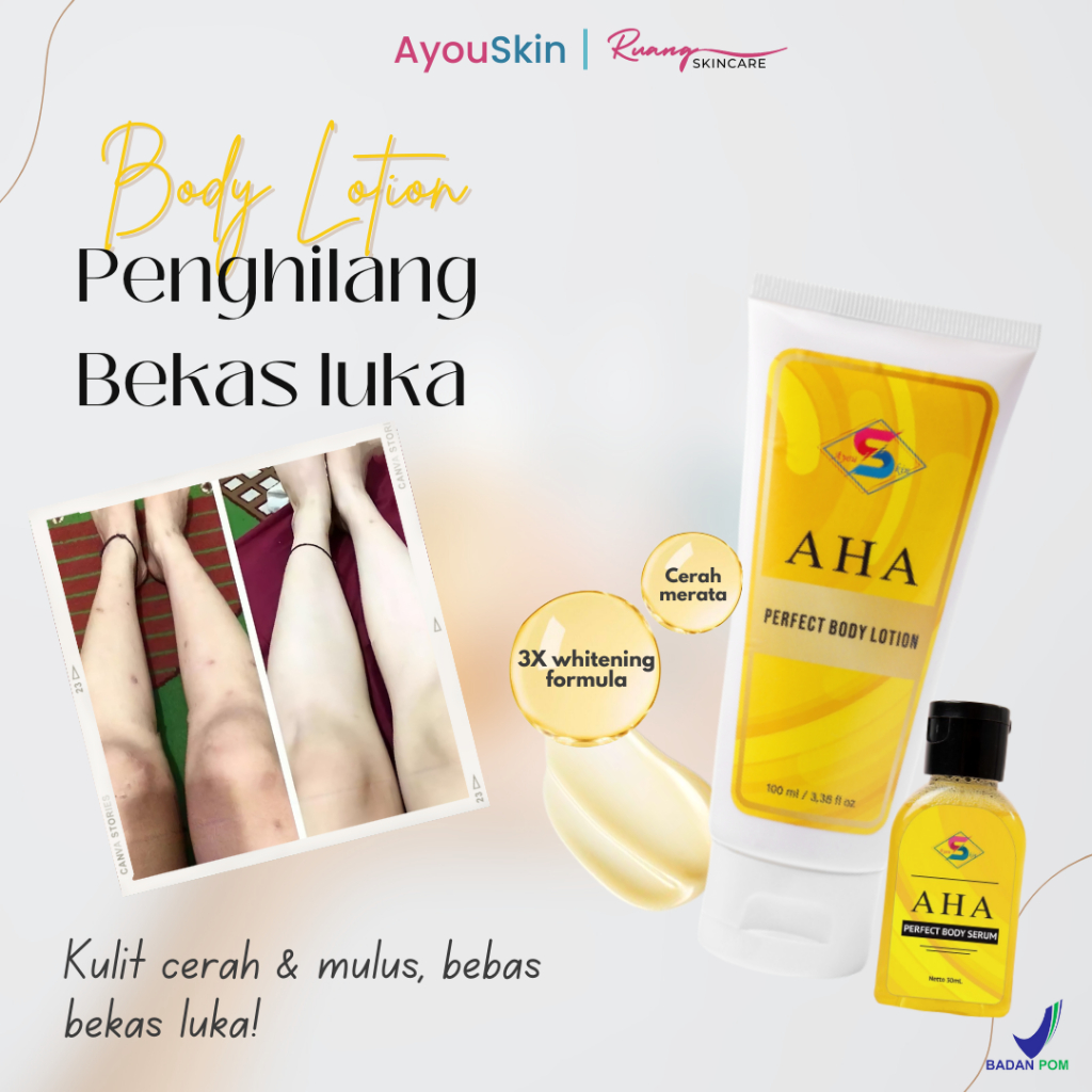Penghilang Bekas Koreng Ampuh, Lotion Penghilang Bekas Luka Lama,krim pembersih korengan, Penghilang