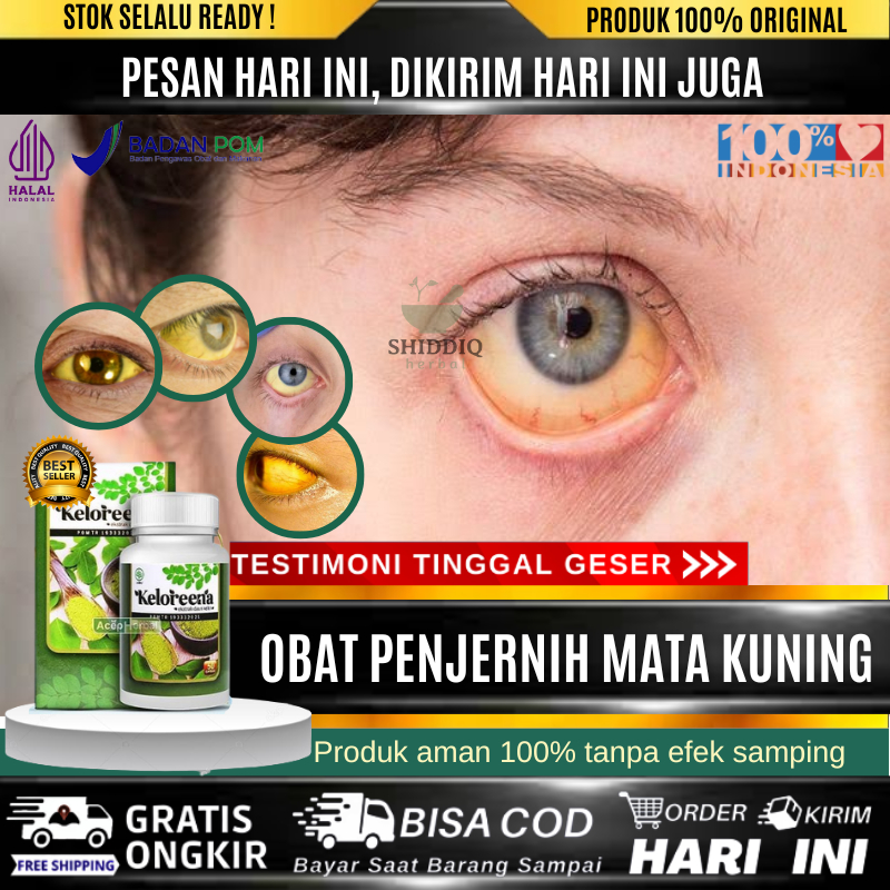 Obat Mata Kuning, Gangguan Liver, Gangguan Hati, Penyakit Kuning, Obat Penjernih Mata Kuning, Obat P