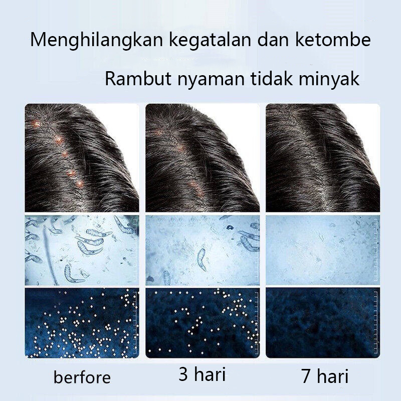 Obat ketombe Sampo Garam Laut Shampoo Obat Ketombe Rambut Rontok Shampo ketombe Obat Ketombe Rambut Rontok Berkerak Sampo 500ML Singkirkan ketombe Memperbaiki kulit kepala yang gatal  Pembersihan mendalam dan kontrol minyak Rambut lebih halus