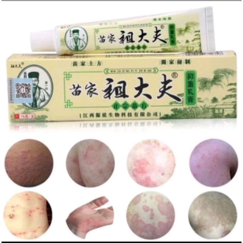 

salap zaidufu||salap gatal jamur