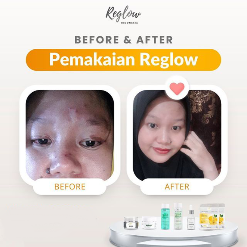Serum Reglow dr Shindy Skincare Perfect Glowing and Whitening Serum Perawatan Kulit BPOM