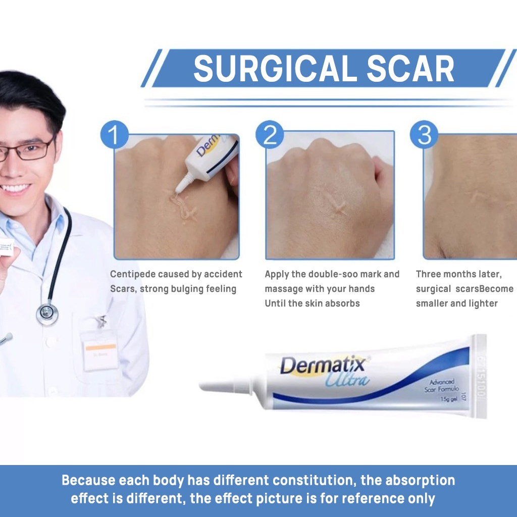 Dermatix Ultra Gel 15gr Advanced Scar Formula Gel LKrim Penghilang Bekas Luka / Bakar / Keloid Anti Scar Stretchmark Dermatik Dermatic