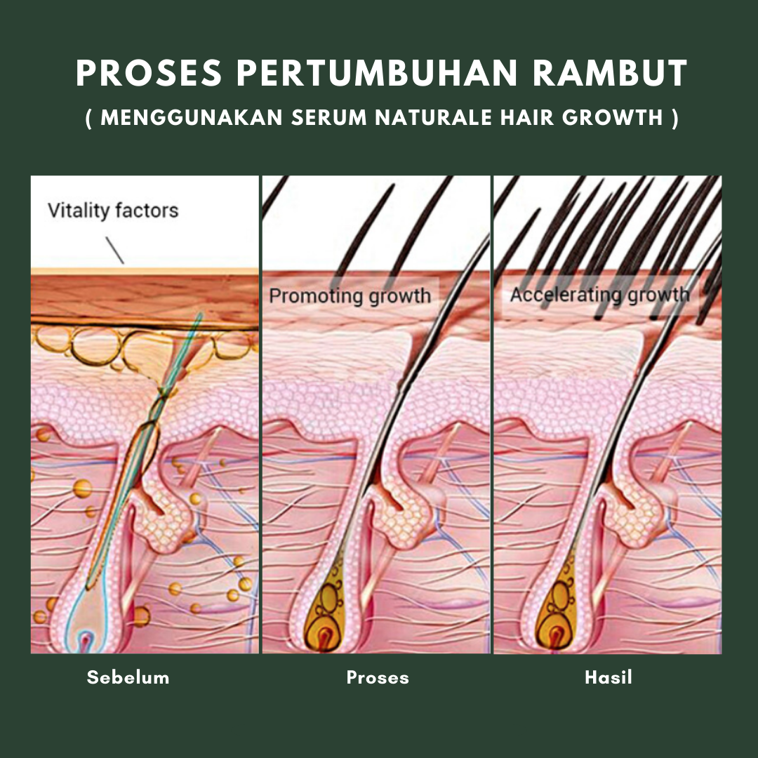 Serum NHG Naturale Hair Growth penumbuh bulu