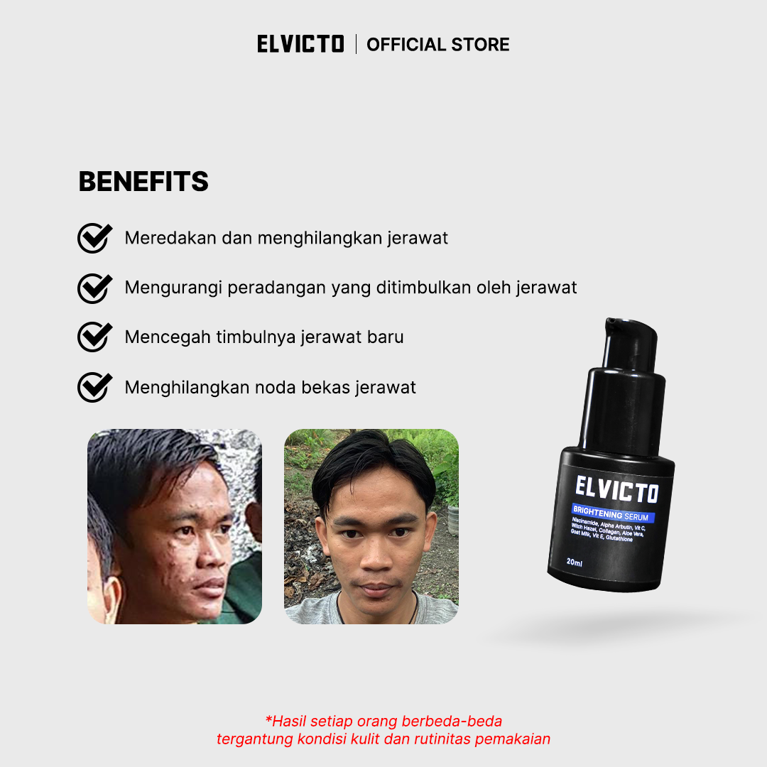 ELVICTO BRIGHTENING SERUM 20 ML