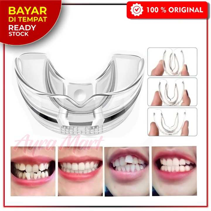 Alat perapih gigi berantakan original Alat perapih gigi tidak rata Alat perapih gigi tonggos origina