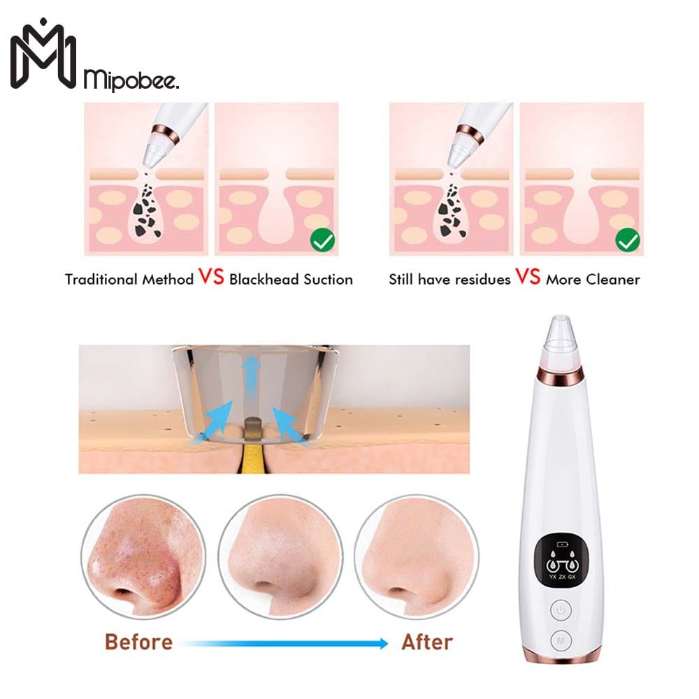 Alat Pembersih Wajah Vacuum Comedo Blackhead (Penyedot Komedo)