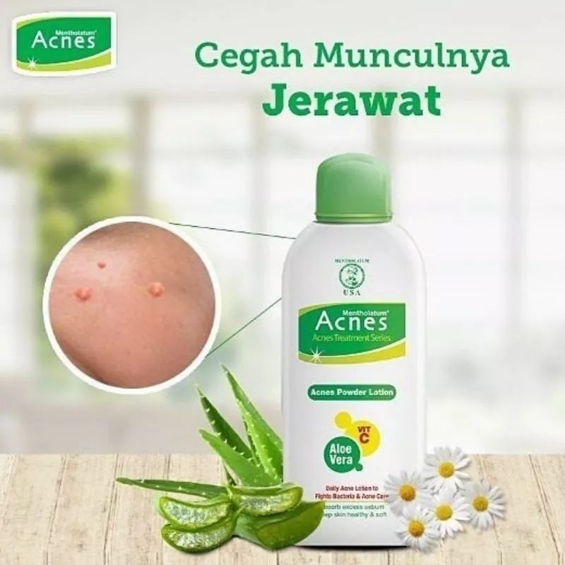 ACNES POWDER LOTION 100ML