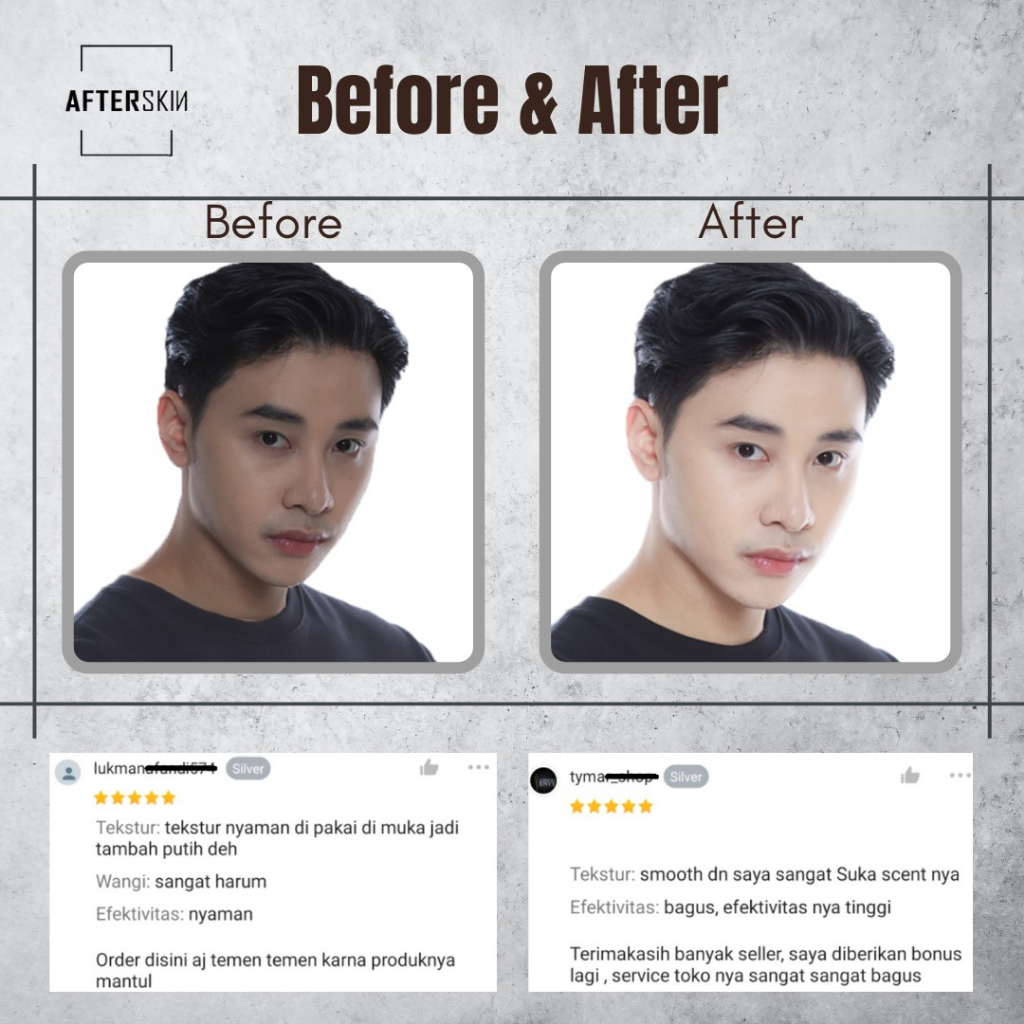 [FOR MEN] AFTERSKIN WHITENING FACE CREAM WAJAH PRIA ALA KOREA BPOM HALAL / SKINCARE PEMUTIH DAN PENCERAH