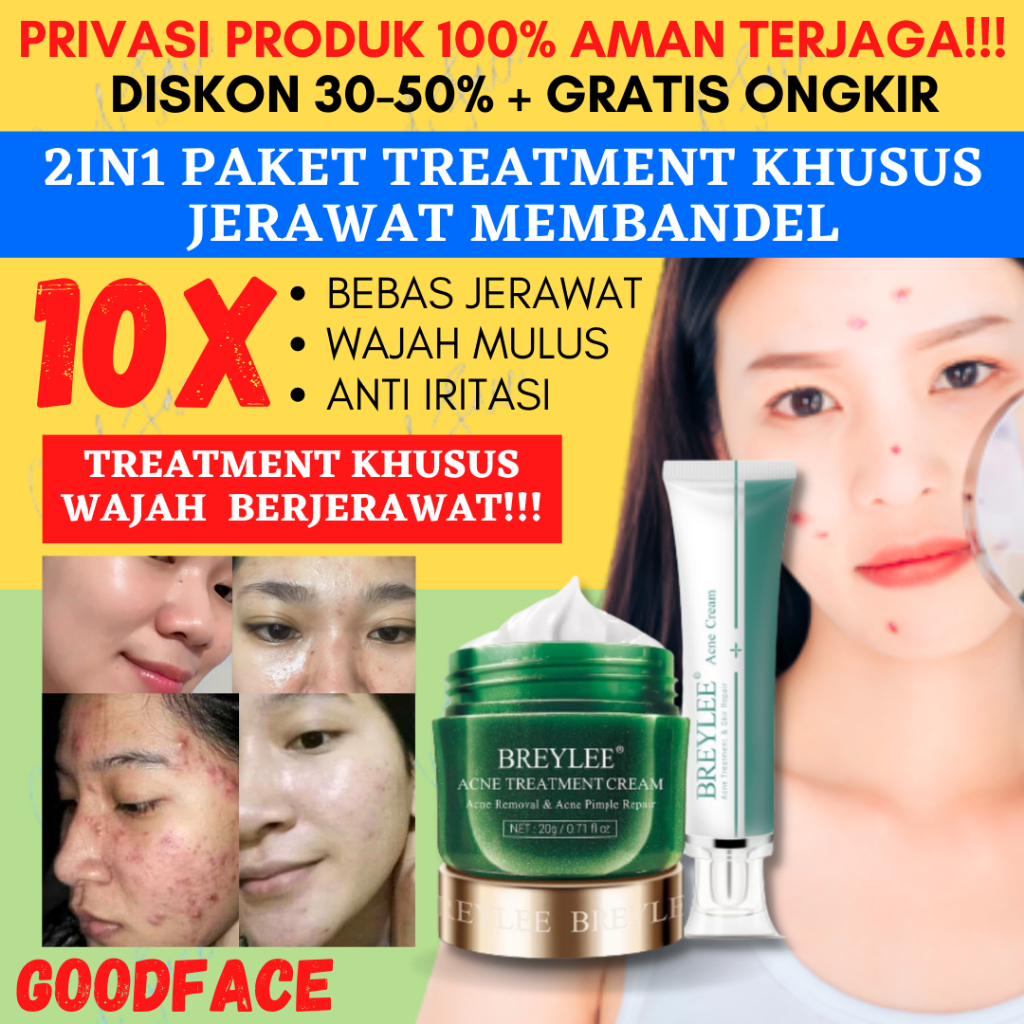PENGHILANG JERAWAT BREYLEE Acne Cream Set Mengatasi &amp; Menghilangkan Noda Jerawat (2pcs)