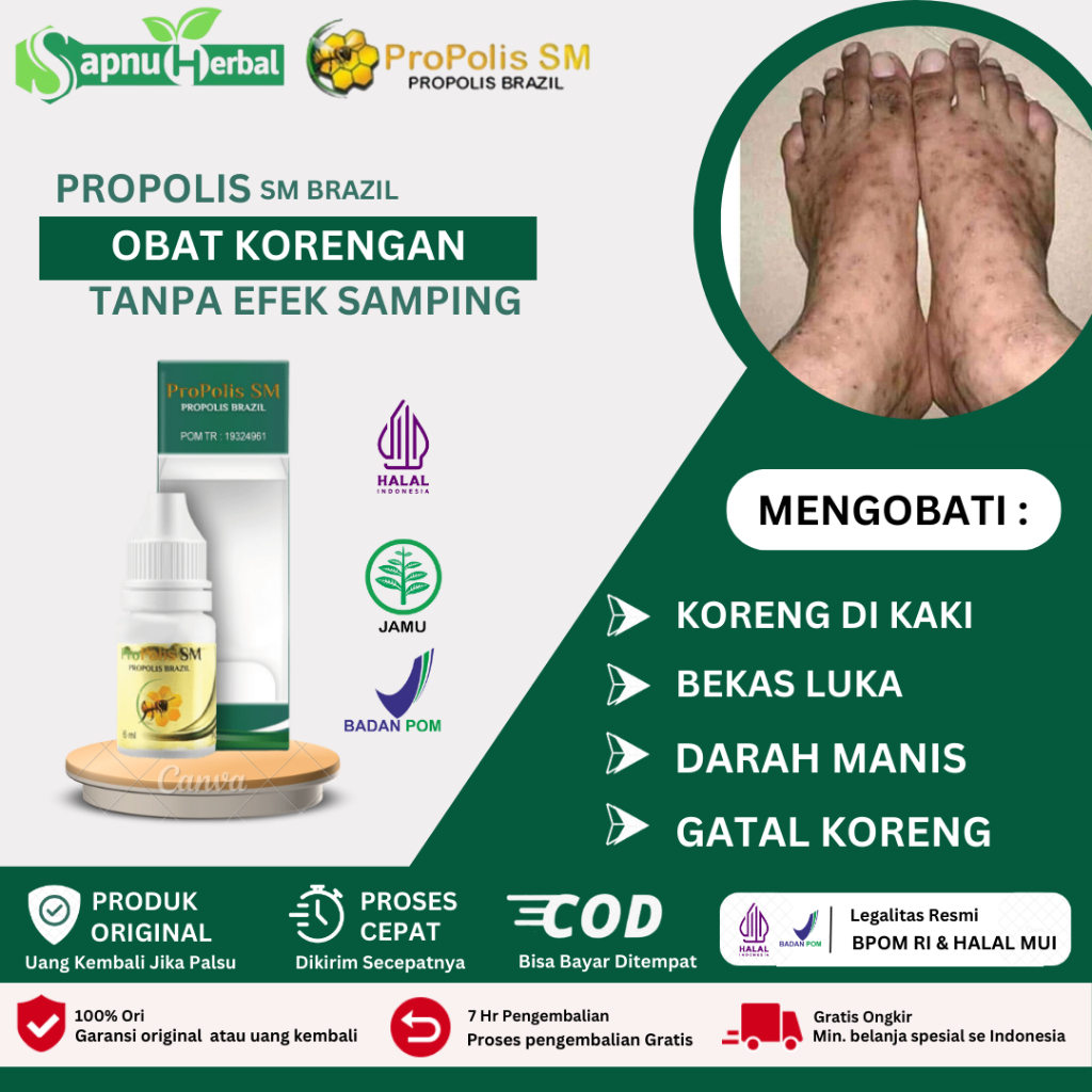 Obat Koreng, Obat Koreng Bernanah, Obat Bekas Koreng, Obat Darah Manis, Obat Gatal Koreng Bernanah, 