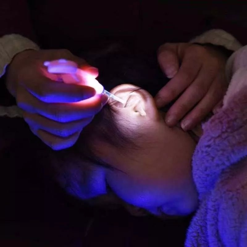 Alat Pembersih Telinga / Korek Kuping Earpick dengan Lampu LED Untuk Bayi Anak ear pick