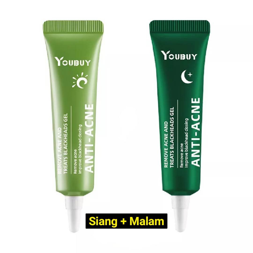 Youbuy anti-acne remove acne and Treats Blackhead / SPOT CARE ACNE TREATMENT /Gel jerawat