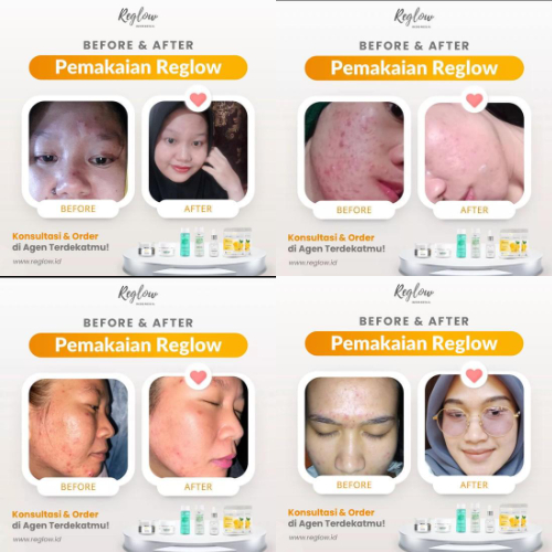 PROMO 7.7 Reglow Paket Glowing + Intensive Whitening Night Cream Skincare Dokter Shindy