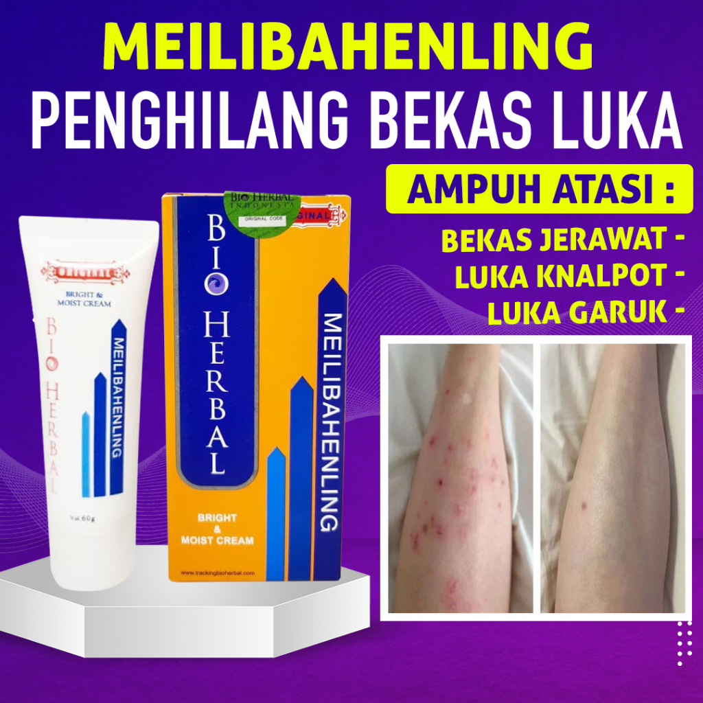 Bio Herbal Meilibahenling Original 100% Obat Cream Penghilang Bekas Luka Lama Hitam Koreng Bopeng Ampuh BPOM Resmi Mengobati Luka Kulit Asli Halal Berkhasiat Untuk Menghilangkan Semua Jenis Bekas Luka Yang Mengandung Bahan Natural Alami Tanpa Efek Samping