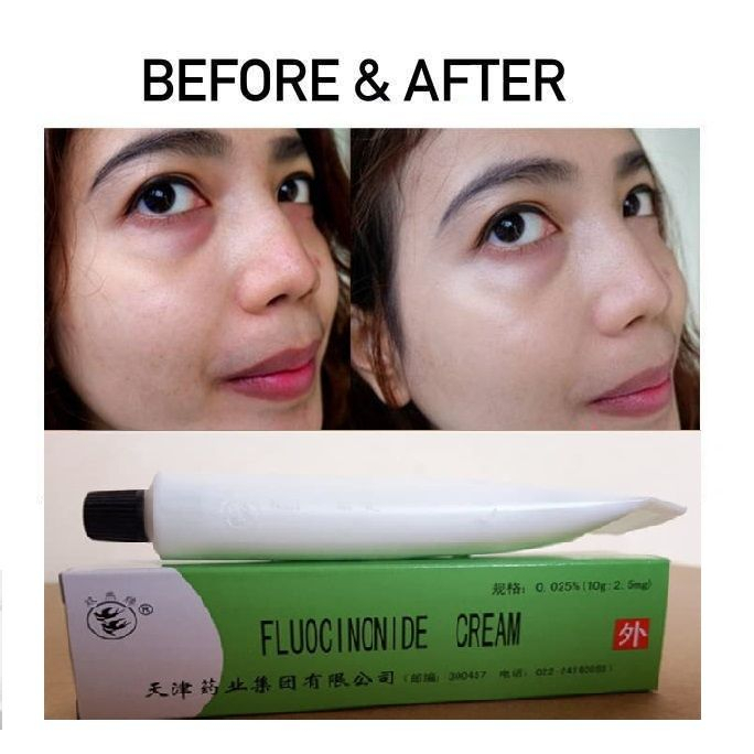 Hope Store - Salep Walet Lightening Cream Lightening Obat Gatal &amp; Penghilang Flek Hitam Membandel Fluocinonide Cream