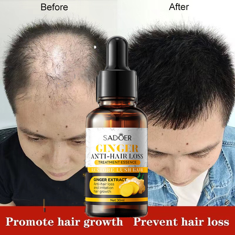 Hair Growth Fluid Ginger Fast Hair Growth Serum Repair Damaged Hair Conditioner  Anti-Hair Loss Promotes Hair Growth