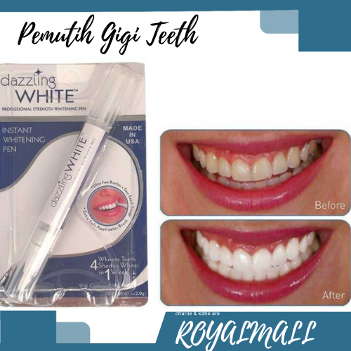 White Pemutih Gigi Teeth Whitening Essence Serum / Pemutih Pencerah Pembersih Penghilang Noda Peront