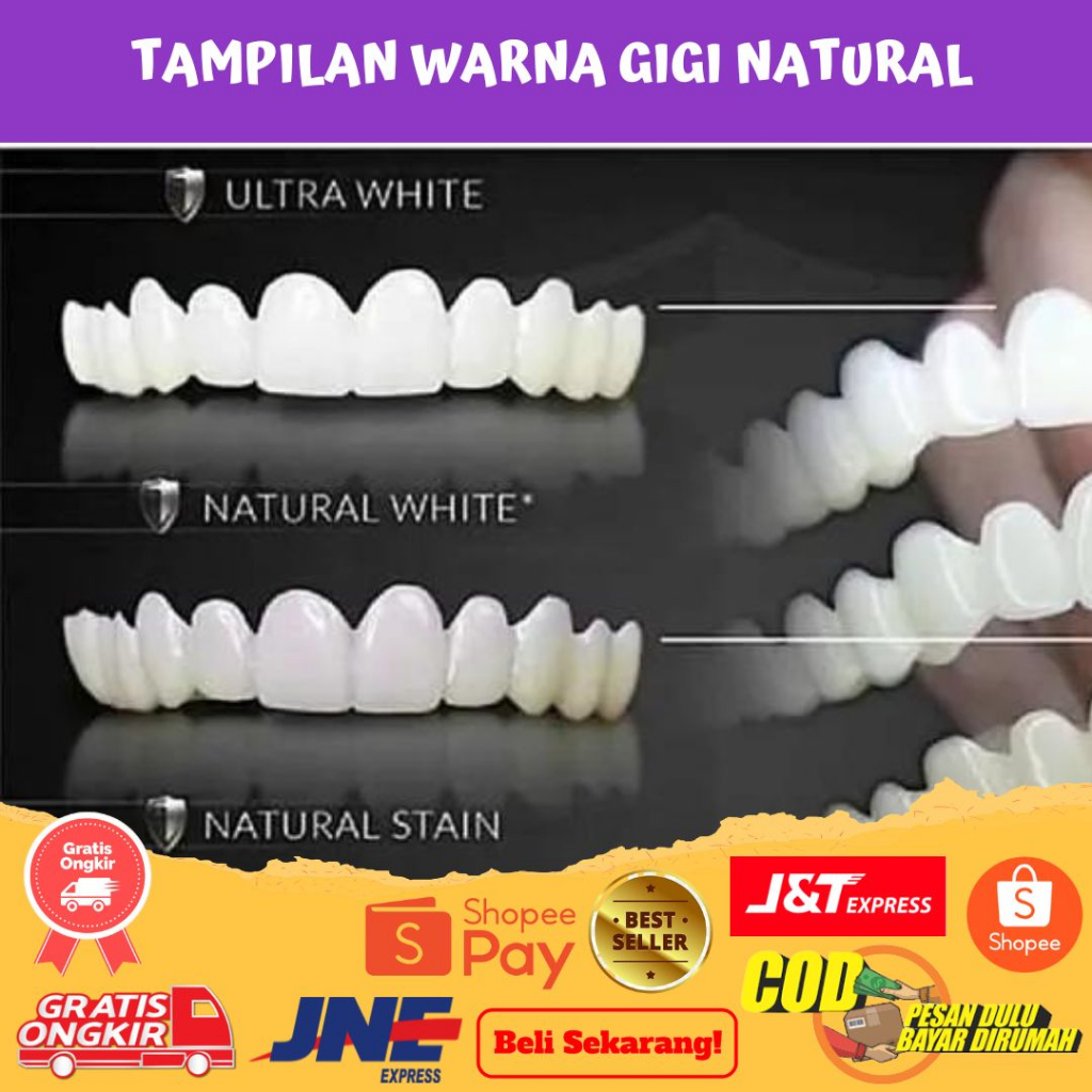BISA COD 100 % GIGI PUTIH PALSU TERLARIS SNAP ON SMILE SATU SET ATAS BAWAH
