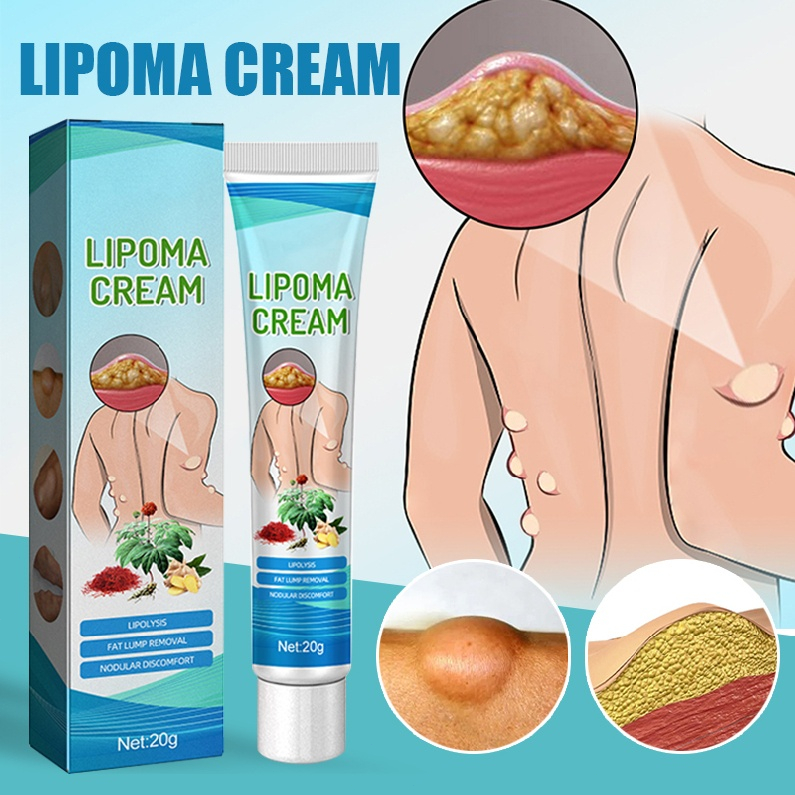 [100% asli] Obat benjolan Obat Benjolan lipoma Benjolan di Leher Benjolan Di Tangan Benjolan Di Ketiak Benjolan Di Punggung Pundak Benjolan Di Kaki Selangkangan Telinga Gondok Hipertiroid Kelenjar Tiroid Limfoma Limpoma Lipoma Kelenjar Herbal 20Gr