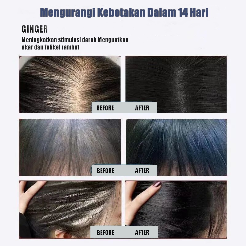 SADOER Plant Ginger Shampoo 500ml Gentle Dandruff Removal Menutrisi Rambut Pertumbuhan Rambut Cepat