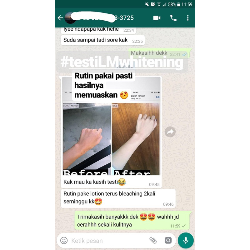 LM Whitening Body Lotion