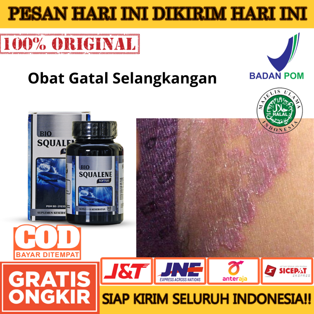 Obat Gatal Selangkangan, Menghilangkan Bekas Hitam Diselangkangan, Iritasi Selangkangan, Selangkanga